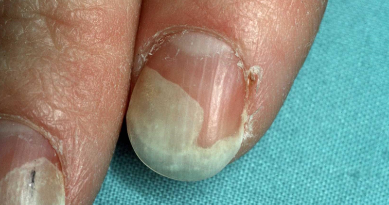 Imagen: Dermquest